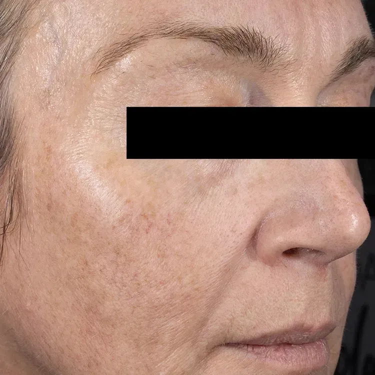 Free VOL.U.LIFT Volume Skin Firming Treatment